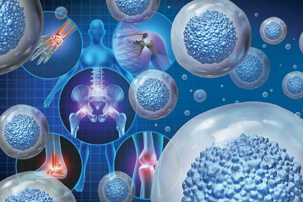 Células Madre y Formación de Tejido Cicatricial